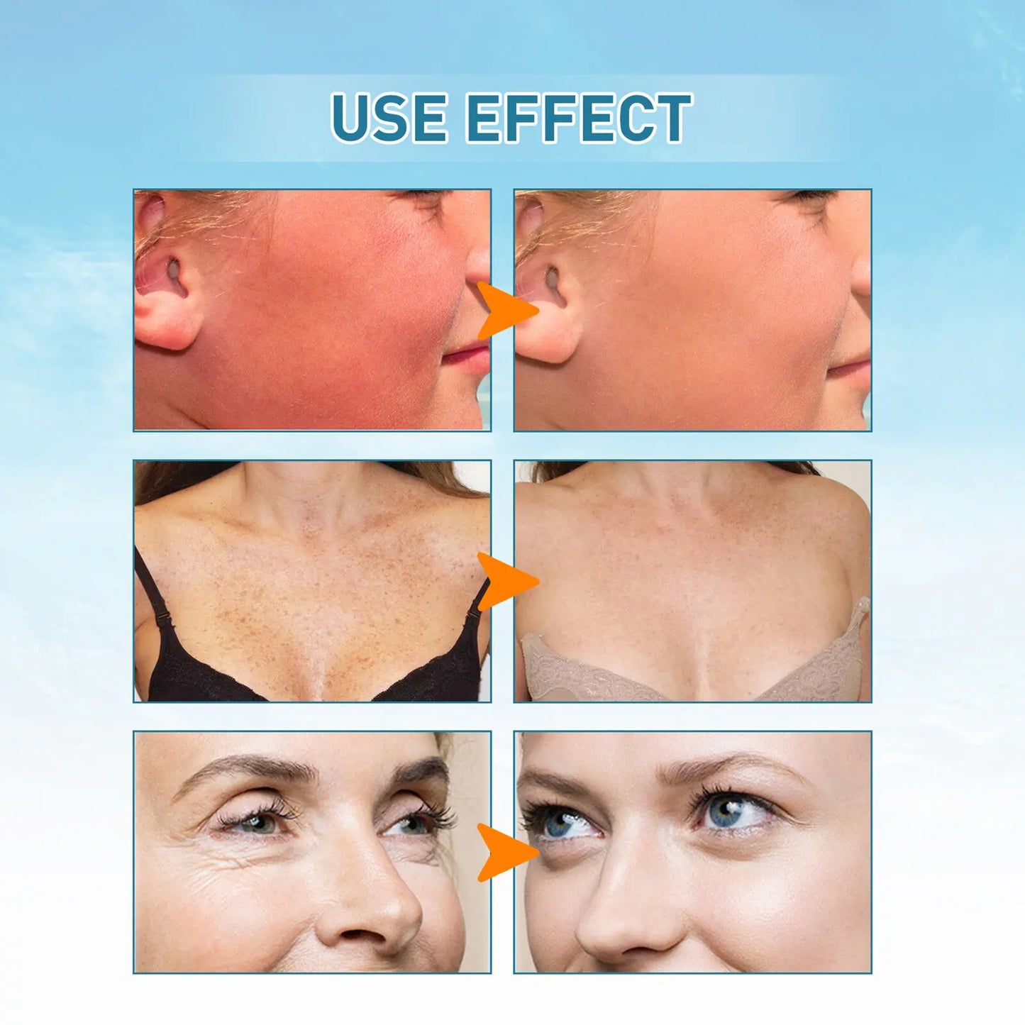 Skin Hydrating Sunscreen
