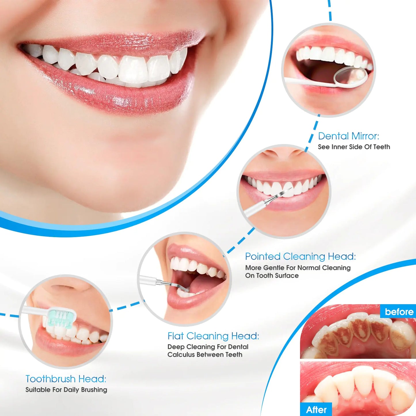 Plaque/Tartar Remover for Teeth