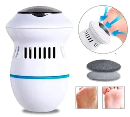 Foot Hard Skin Remover and Smoother