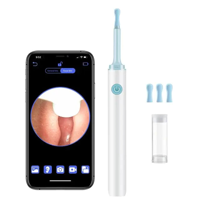 Smart Ear Wax Removal and Cleaning Tool with Camera Kit