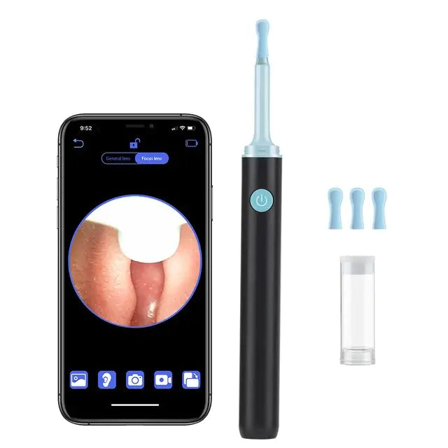 Smart Ear Wax Removal and Cleaning Tool with Camera Kit