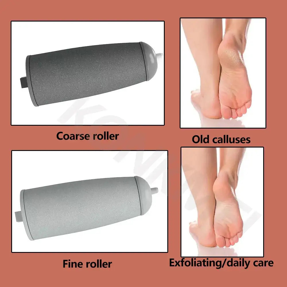 Electric Foot Callus Remover