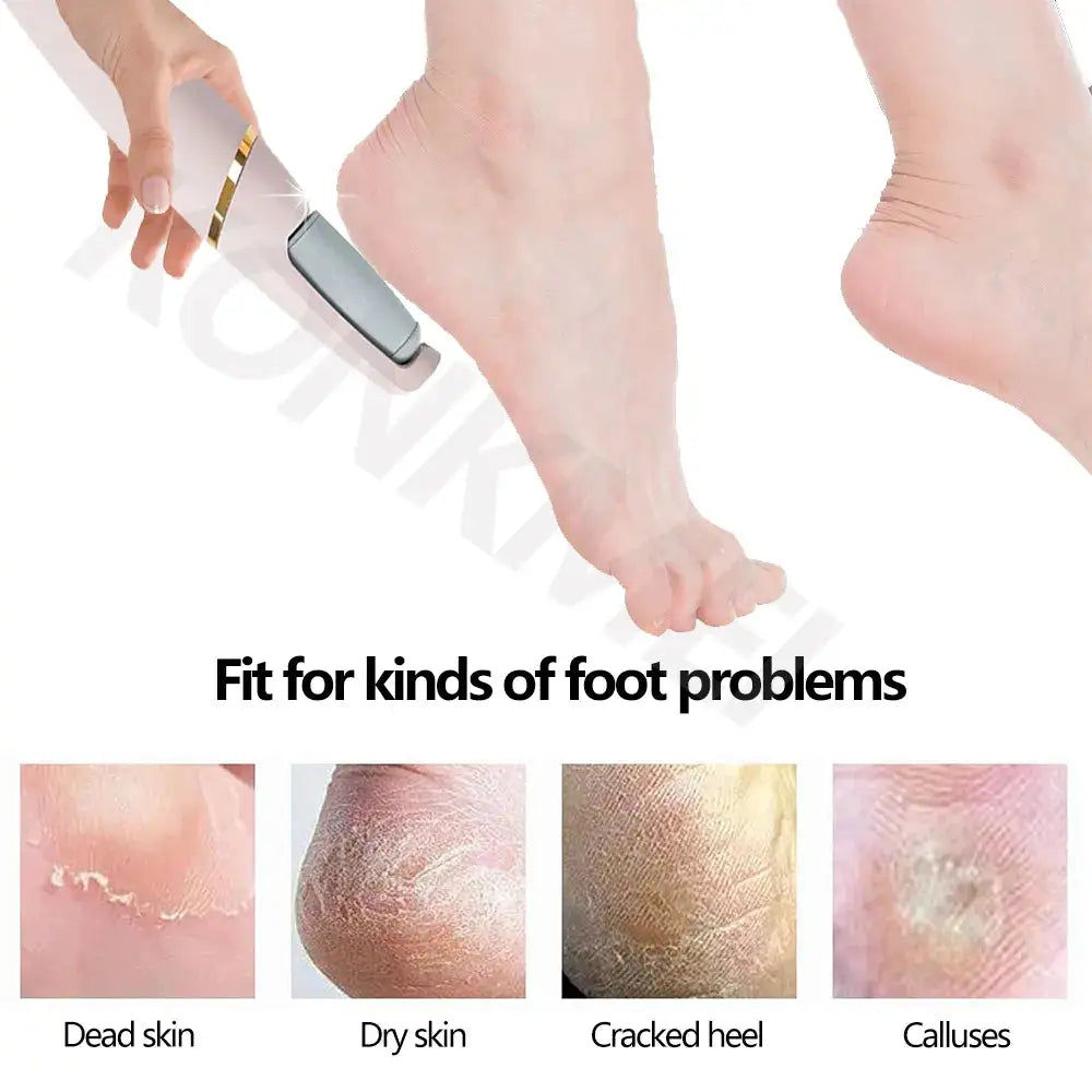 Electric Foot Callus Remover